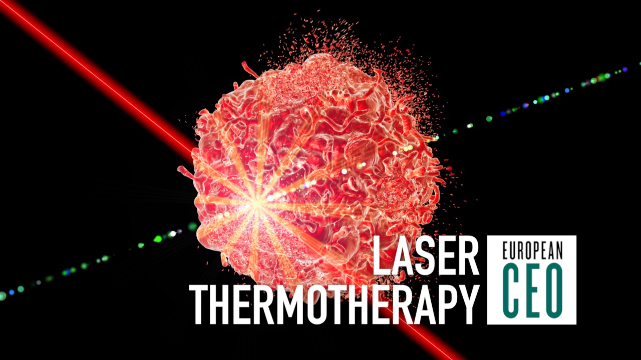 Laser Therapy For Cancer May Promote Better Immune Response Orbi News